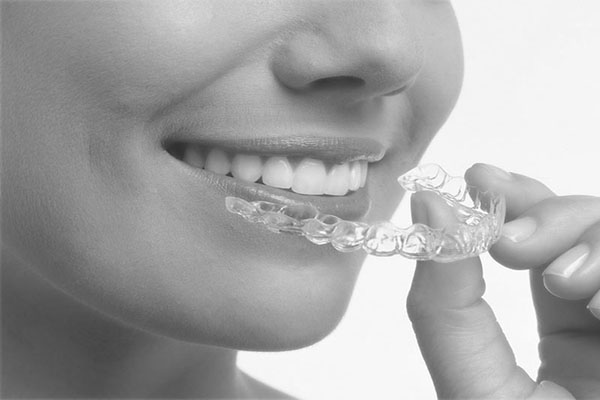 invisalign in London Harley Street